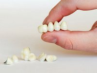 состояние полости рта после имплантации зубов