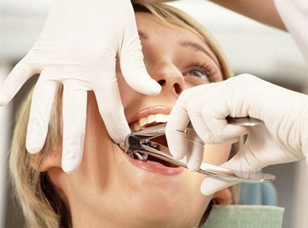 Удаление зуба с кистой