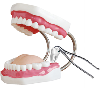 удаление зубов без боли